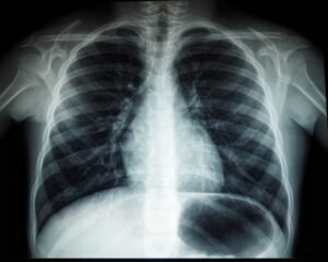 Photo MRI scan